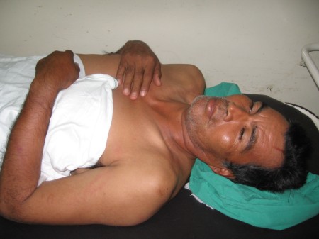 Marcial Hernandez, hospitalizado por golpes durante su detencion en Choloma, el 14 de agosto. Foto: Sandra Cuffe